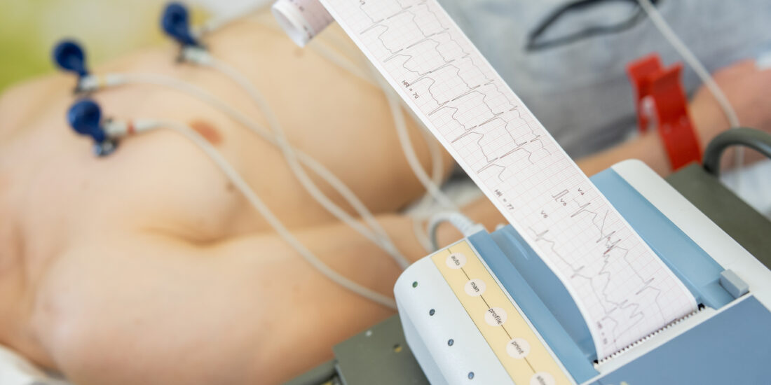 EKG Zdjęcie Kardiosfera