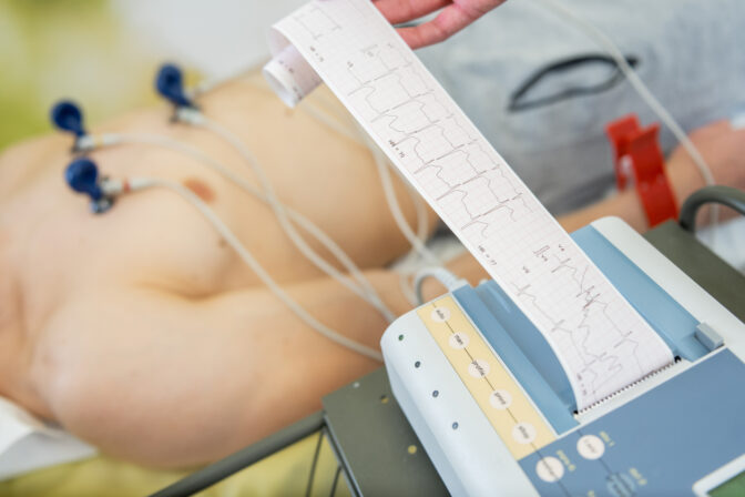 EKG Zdjęcie Kardiosfera