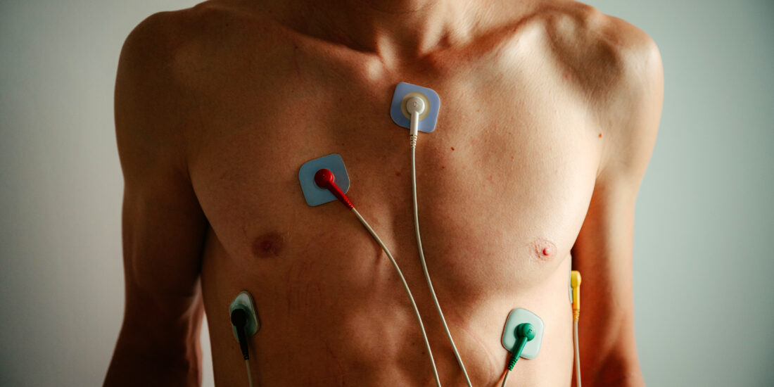 Holter EKG