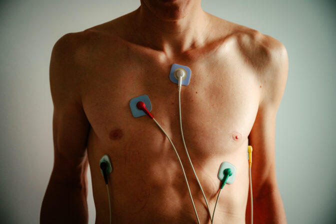 Holter EKG